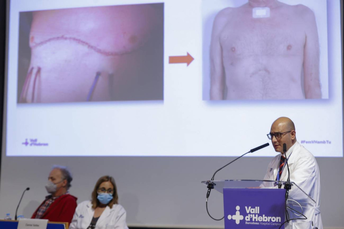 Realizan el primer trasplante de pulmon completamente robotico sin abrir el torax