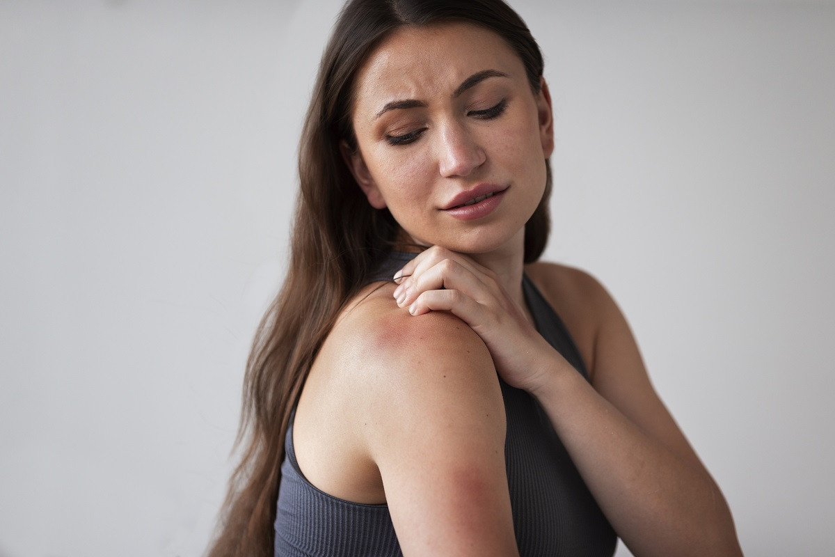 2 Se ha demostrado una asociaciu00f3n directa de la dermatitis atu00f3pica con el estru00e9s, dado que este puede actuar como impulsor de los brotes en un 40% 50% de los casos