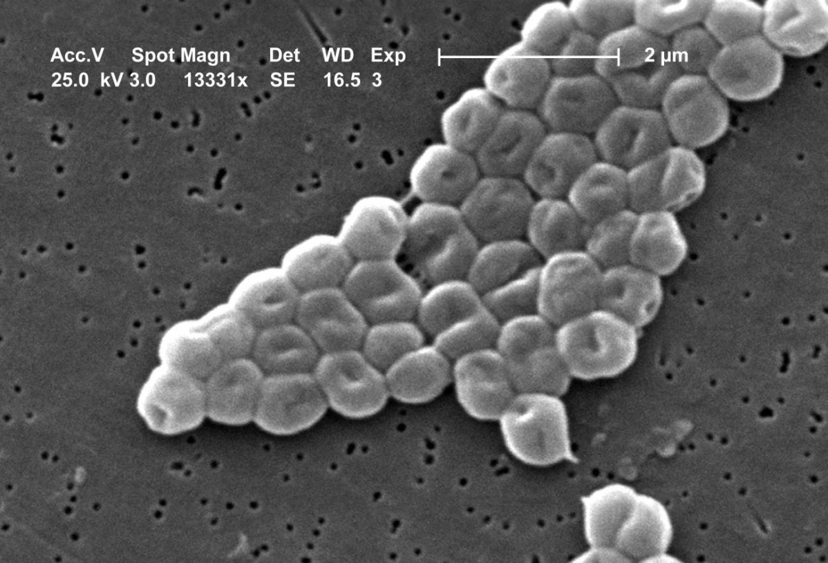 La batalla entre dos virus en una bacteria abre nuevas vias contra la resistencia a antibioticos