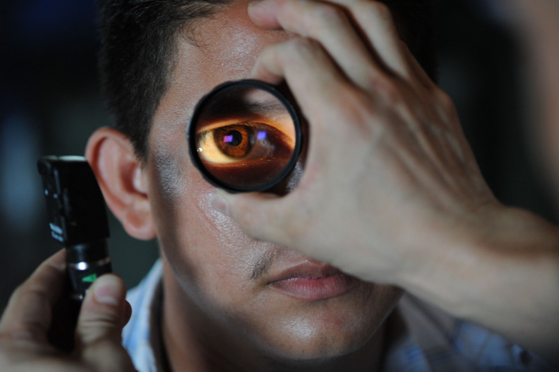 Ocular.