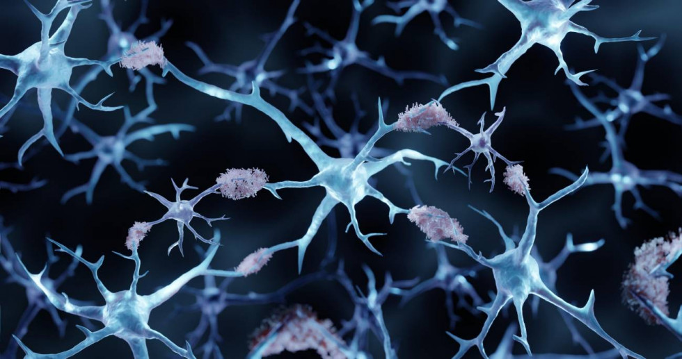 Consiguen revertir el alzheimer en ratones con el uso de nanoparticulas