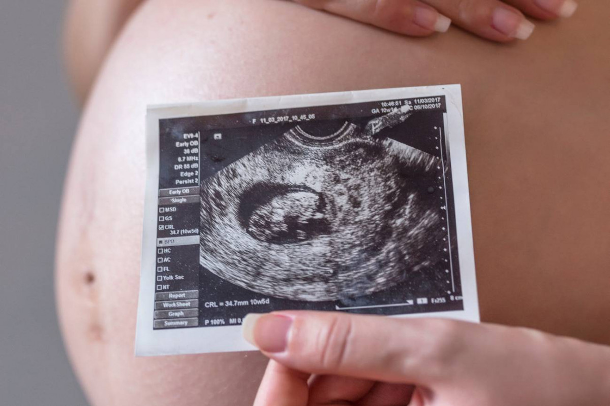 Relacionan la contaminacion del aire con cambios en el desarrollo cerebral fetal