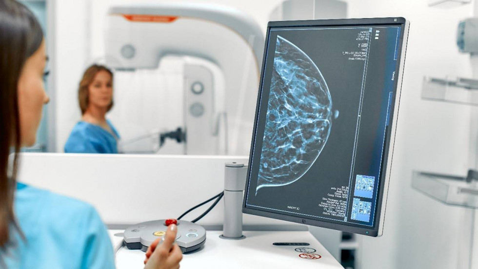 Una densidad mamografica alta podria estar asociada con tumores de peor pronostico