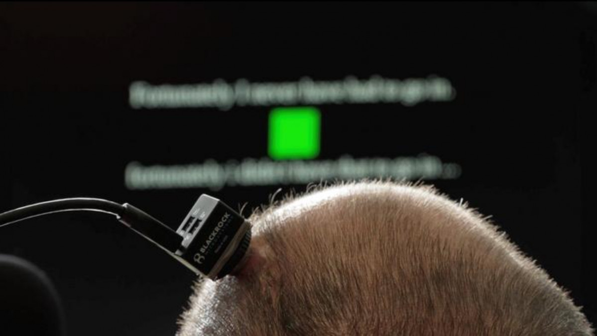 Implantecerebralpermitehablar